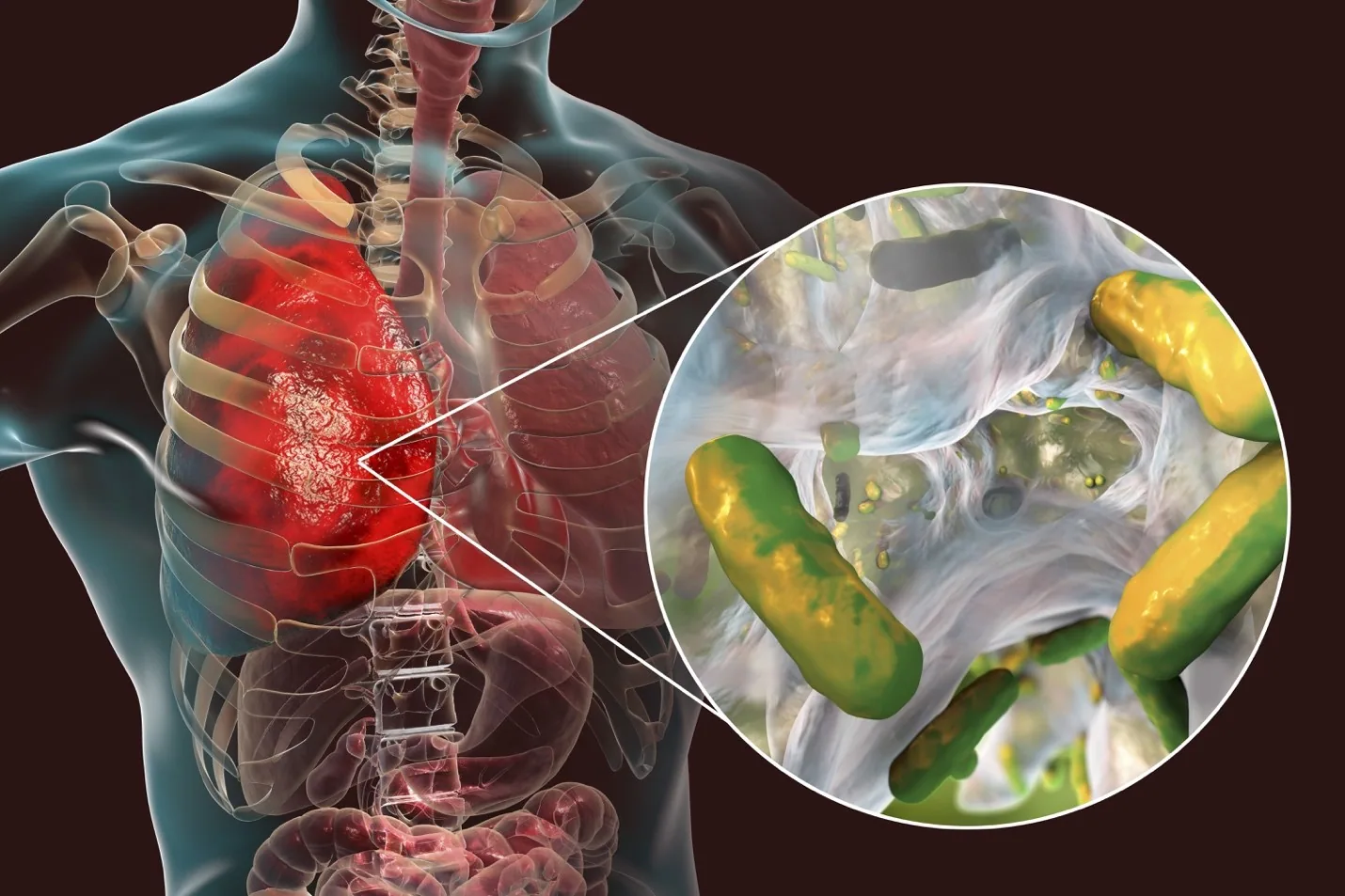 Illustration from The Role of Glutathione in Disrupting Biofilms