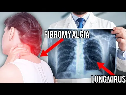 Live Q&A with Dr. Purser | Fibromyalgia and How to Combat Viral Lung Infections video thumbnail