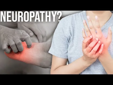 Do You Have Chemo Neuropathy? video thumbnail